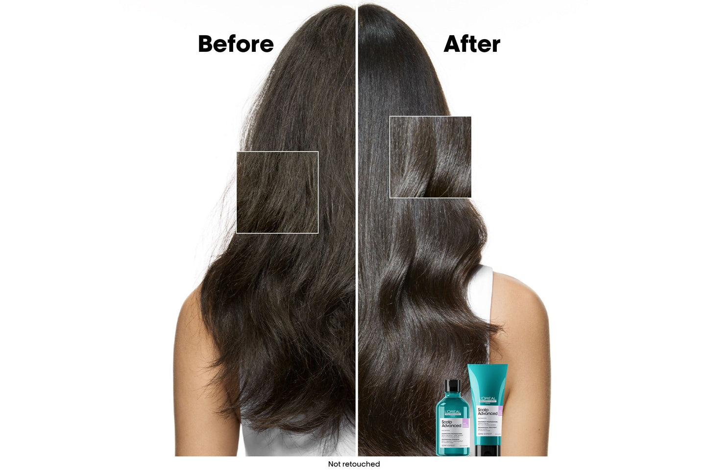 Loreal Pro Scalp Advanced Anti-Discomfort Shampoo 300ml