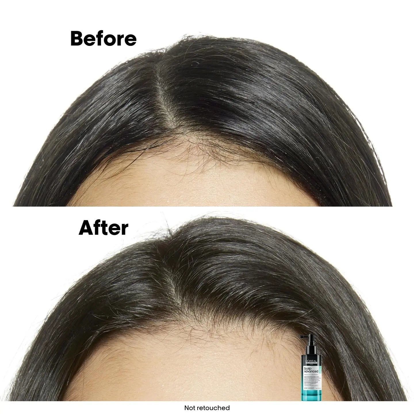 Loreal Pro Scalp Advanced Anti-Oil Serum 90ml